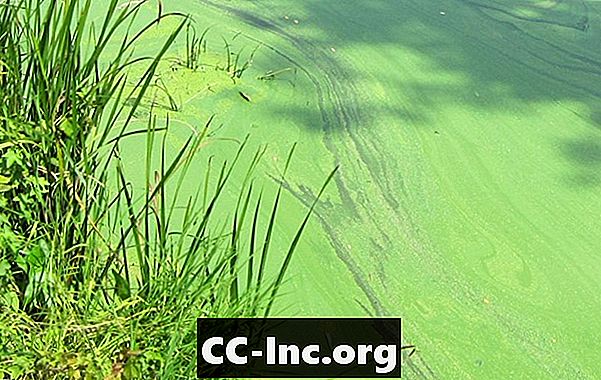 Modro-zelene alge