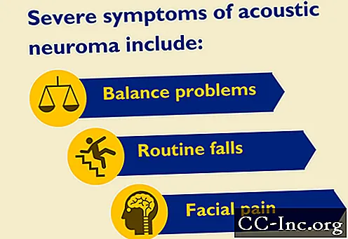 Akustisk nevrom: 4 behandlingsscenarier
