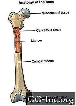 Biopsi Tulang
