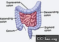 colostomy