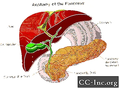 Computertomografie (CT) -scan van de pancreas