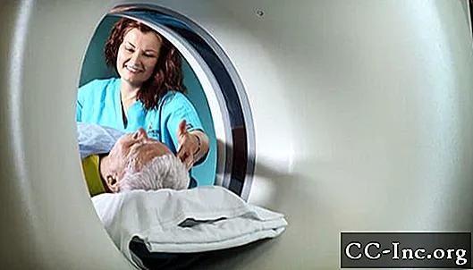 Skeniranje računalne tomografije (CT)