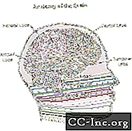 Kompiuterinė tomografija (CT arba CAT) smegenų nuskaitymas