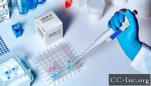 Vanliga frågor om Coronavirus Test