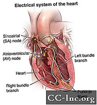 تخطيط القلب الكهربي