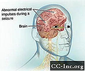 Elektroensefalogram (EEG)