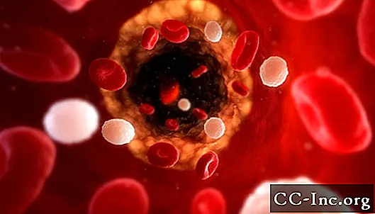 إصلاح الأوعية الدموية في تمدد الأوعية الدموية في البطن