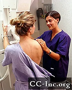 Često postavljana pitanja: mamografi