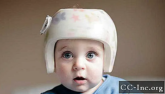Terapia de capacete para seu bebê