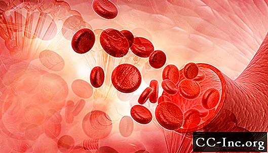 Anemia hemolítica