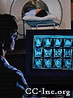 Imagem de ressonância magnética (MRI) do coração