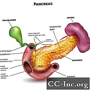 Симптоми на рак на панкреаса