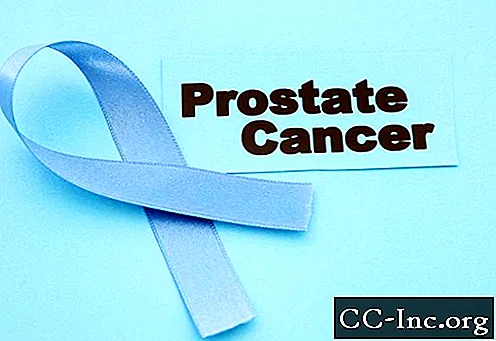 Prostatektomi: Vad du kan förvänta dig under operation och återhämtning - Hälsa