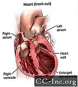 Dešinės širdies kateterizacija