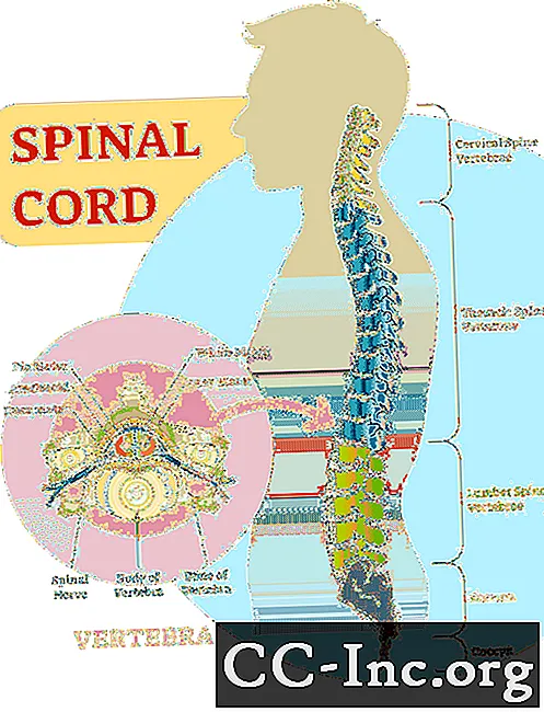 Spinale kanker en spinale tumoren