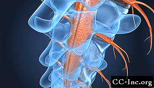 Tumori ale măduvei spinării