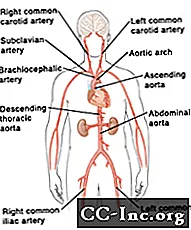 Aneurisma dell'aorta toracica