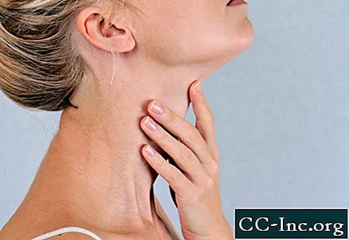 Рак на щитовидната жлеза: Какво трябва да знаят жените