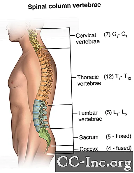RTG hrbtenice, vratu ali hrbta