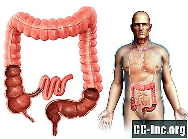 10 činjenica o vašem debelom crijevu