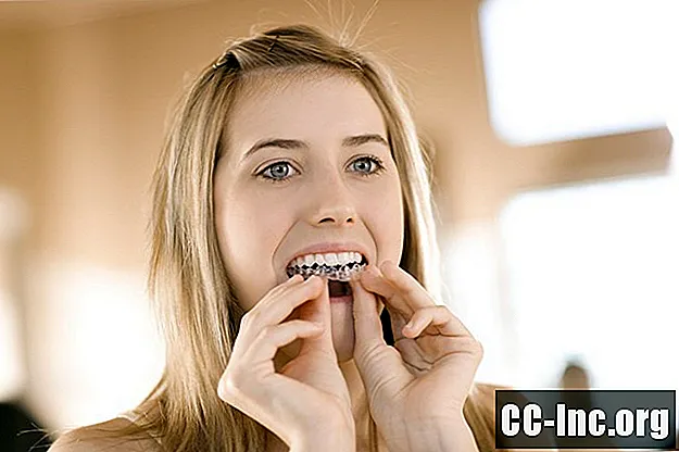 10 استراتيجيات للتعامل مع حساسية تبييض الأسنان