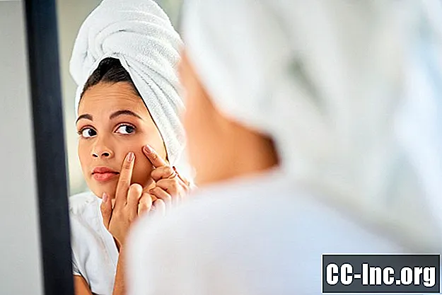 10 ting du må slutte å gjøre for bedre hud