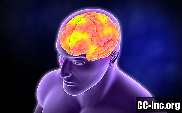 3 tipuri de afazie care pot rezulta din accident vascular cerebral