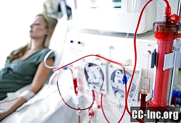 5 Complications de l'hémodialyse