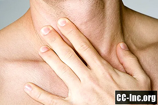 5 Gründe, warum Ihr Hals brennt - Medizin
