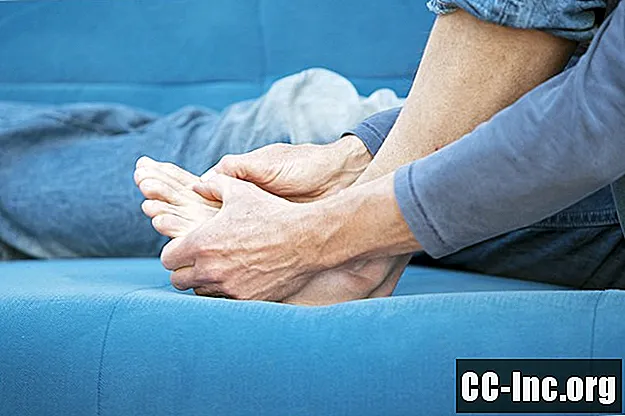5 powodów skurczu palców u nóg