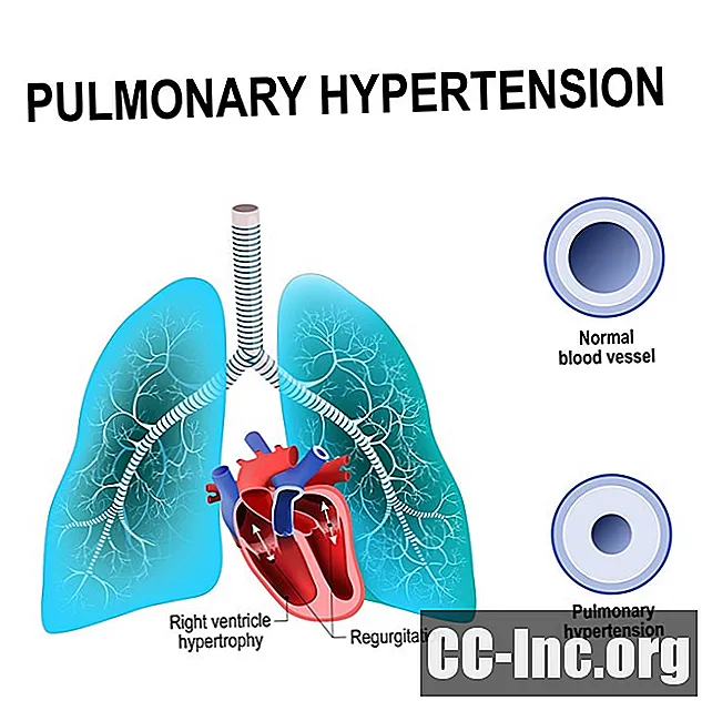 5 typer pulmonal hypertensjon