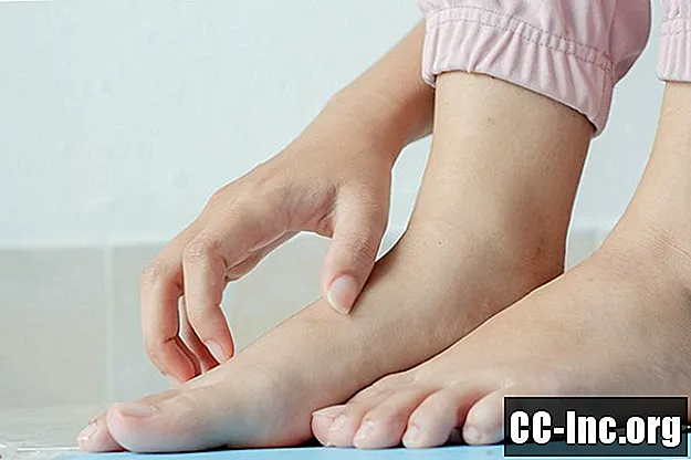 7一般的な足の発疹