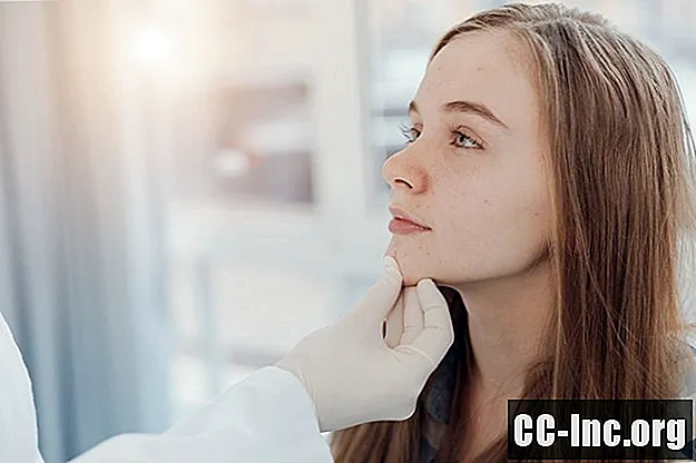 7 tecken som din tonåring borde se en hudläkare för akne