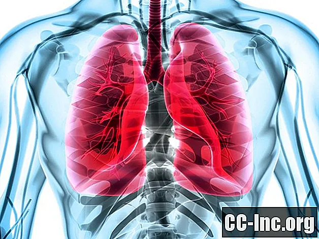 7 lucruri pe care trebuie să le știe toată lumea cu astm