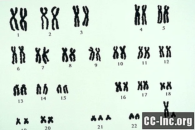 9 Haruldased geneetilised trisoomiad