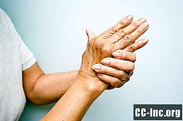 Poliartritas, uždegiminis artritas ir reumatoidinis artritas