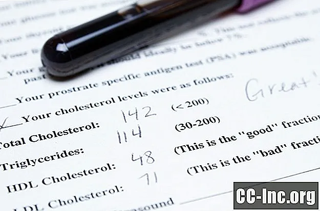 Una guía para el colesterol total