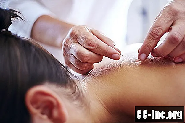 Akupunktur for ryggsmerter og nakkesmerter