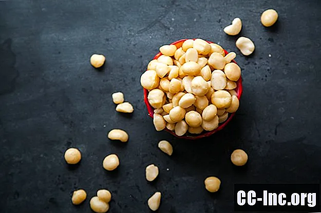 Agregar nueces de macadamia a su dieta puede mejorar su colesterol