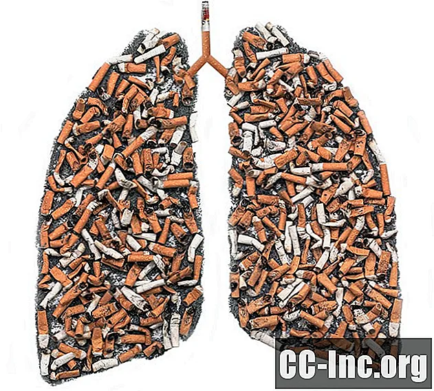 Akciğer Kanseri Damgasını Ele Alma ve Başa Çıkma - Ilaç
