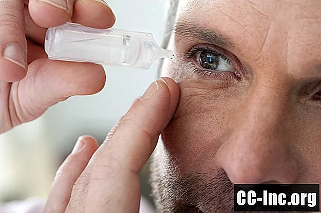 Како се лечи ружичасто око (коњунктивитис)