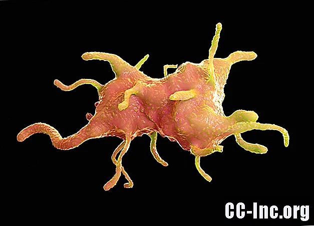 Infecciones por amebas que causan enfermedades cerebrales