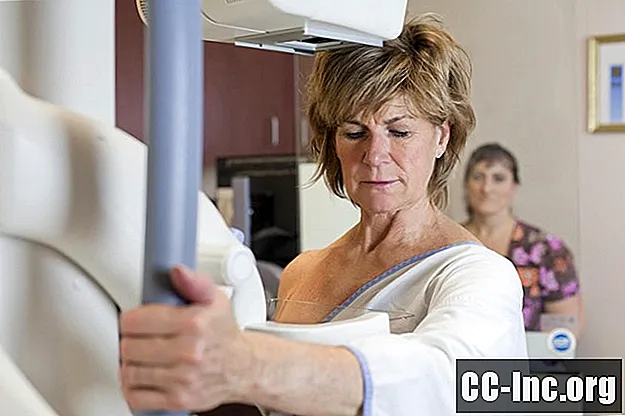 Pregled Invazivni duktalni karcinom (IDC) - Zdravilo