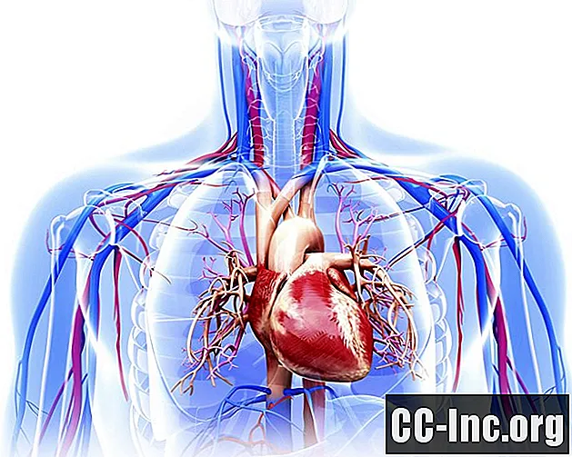 Een overzicht van aortadissectie