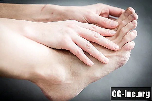 Kojų pirštų artrito apžvalga