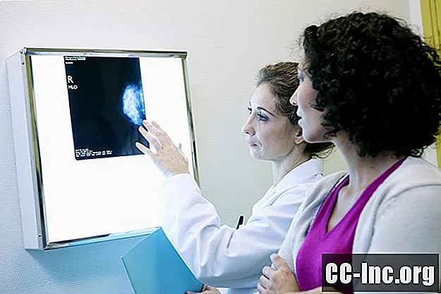 Pregled atipične lobularne hiperplazije dojke