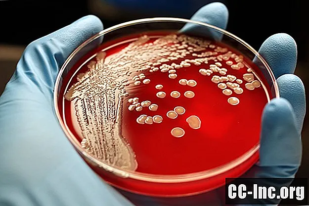 Przegląd infekcji bakteryjnych