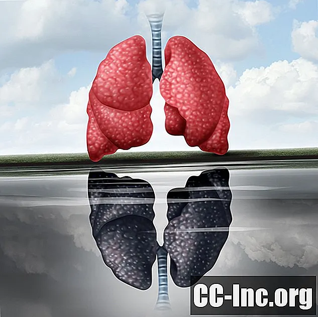 Un aperçu de la maladie pulmonaire noire - Médicament