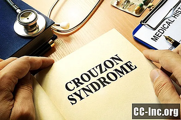 Una descripción general del síndrome de Crouzon