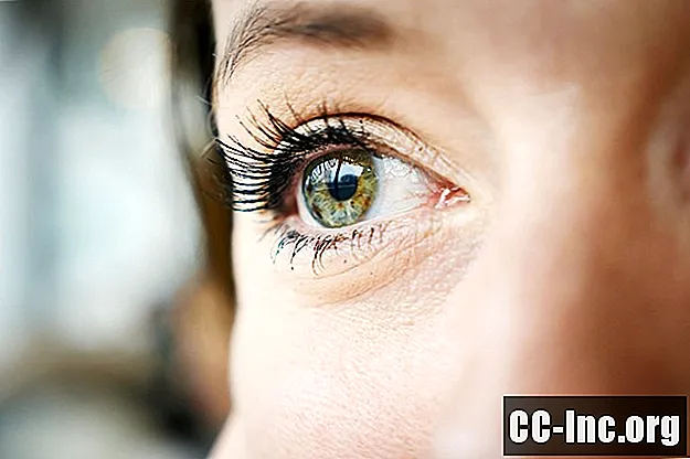 Sausų akių sindromo apžvalga